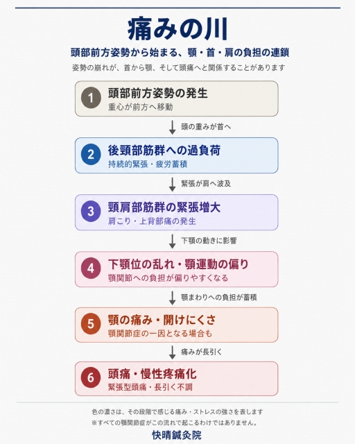 頭部前方姿勢から首こり、肩こり、下顎の動きの乱れ、顎の痛み、頭痛へと負担が連鎖する一例を示した快晴鍼灸院の顎関節症解説図