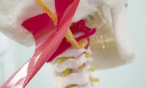 首こり・天柱シンドローム・頭痛