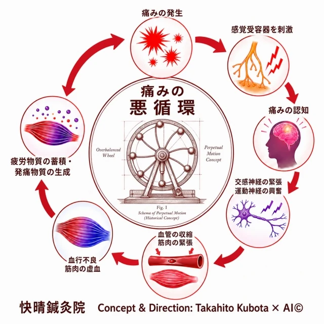 痛みの悪循環の図解｜痛みの発生→神経の興奮→脳が痛みと認識→身構えて筋肉がこわばる→血のめぐりが悪くなる→痛み物質がたまる→再び痛みへ、と続くループを示した解説図｜快晴鍼灸院 足柄上郡開成町