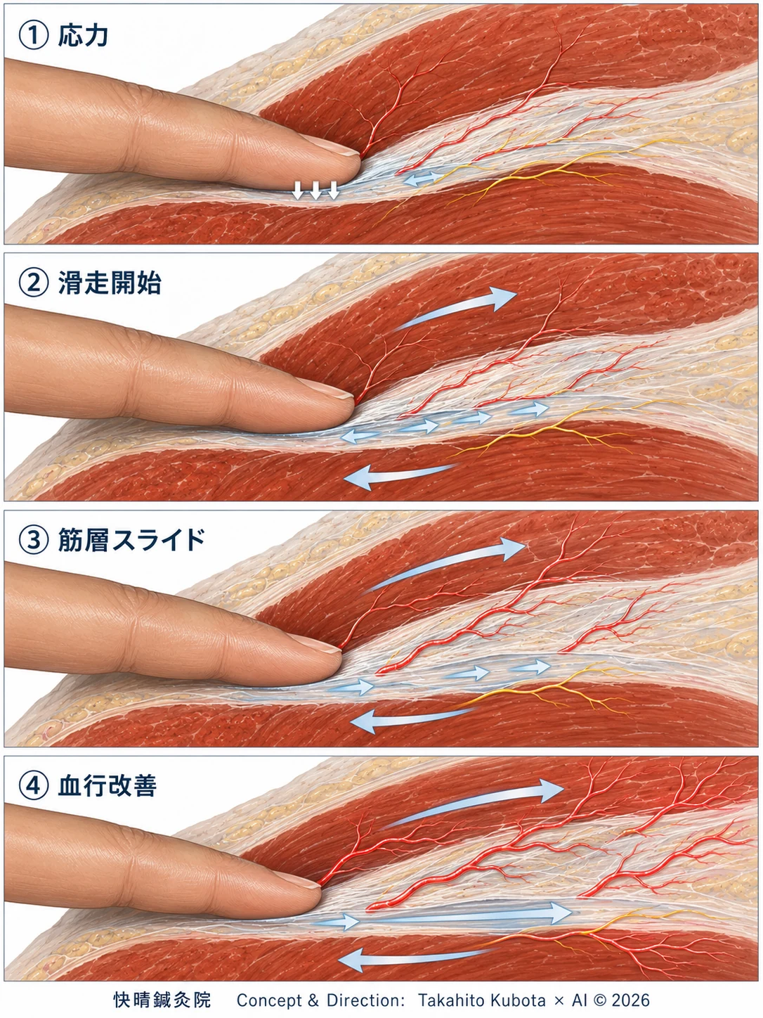 ファシアリリースの4段階を示した解説図。①応力（指で適切に押す）→②滑走開始（筋膜の動きが戻り始める）→③筋層スライド（上下の筋層が互いに滑る）→④血行改善（血流が回復していく）の流れ｜開成町 快晴鍼灸院