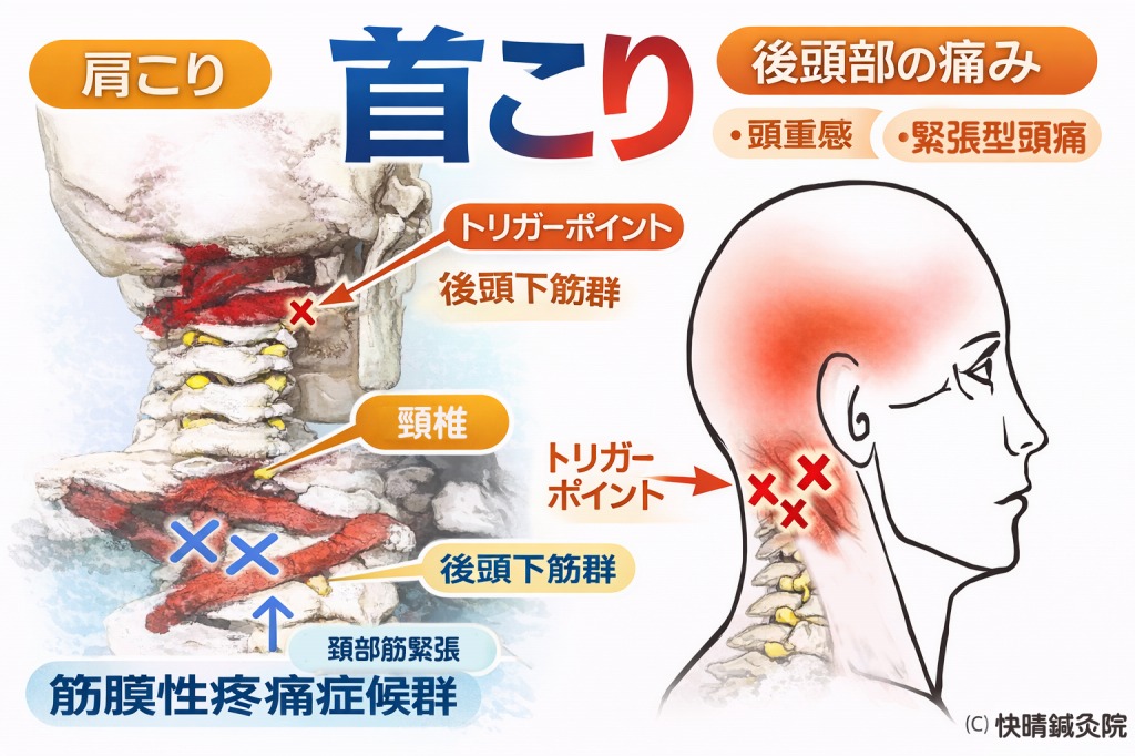 首こり,肩こり,頭痛_マッサージ,鍼灸、整体_開成町_快晴鍼灸院_開成町,開成,南足柄,足柄,小田原